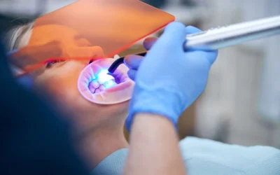 Qué comer durante un blanqueamiento dental: guía práctica para cuidar tu sonrisa
