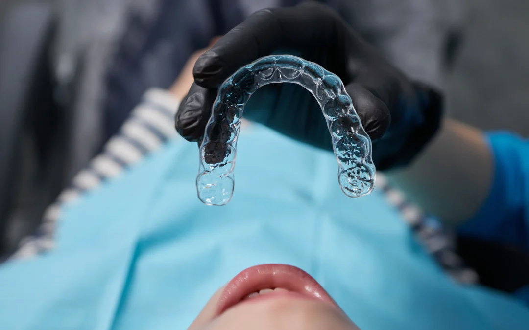 Spark vs. Invisalign